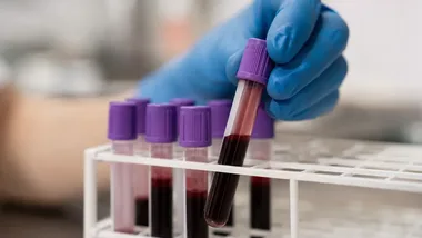 Bezpłatne badania HCV w Będzinie. Sprawdź, kto może się zgłosić